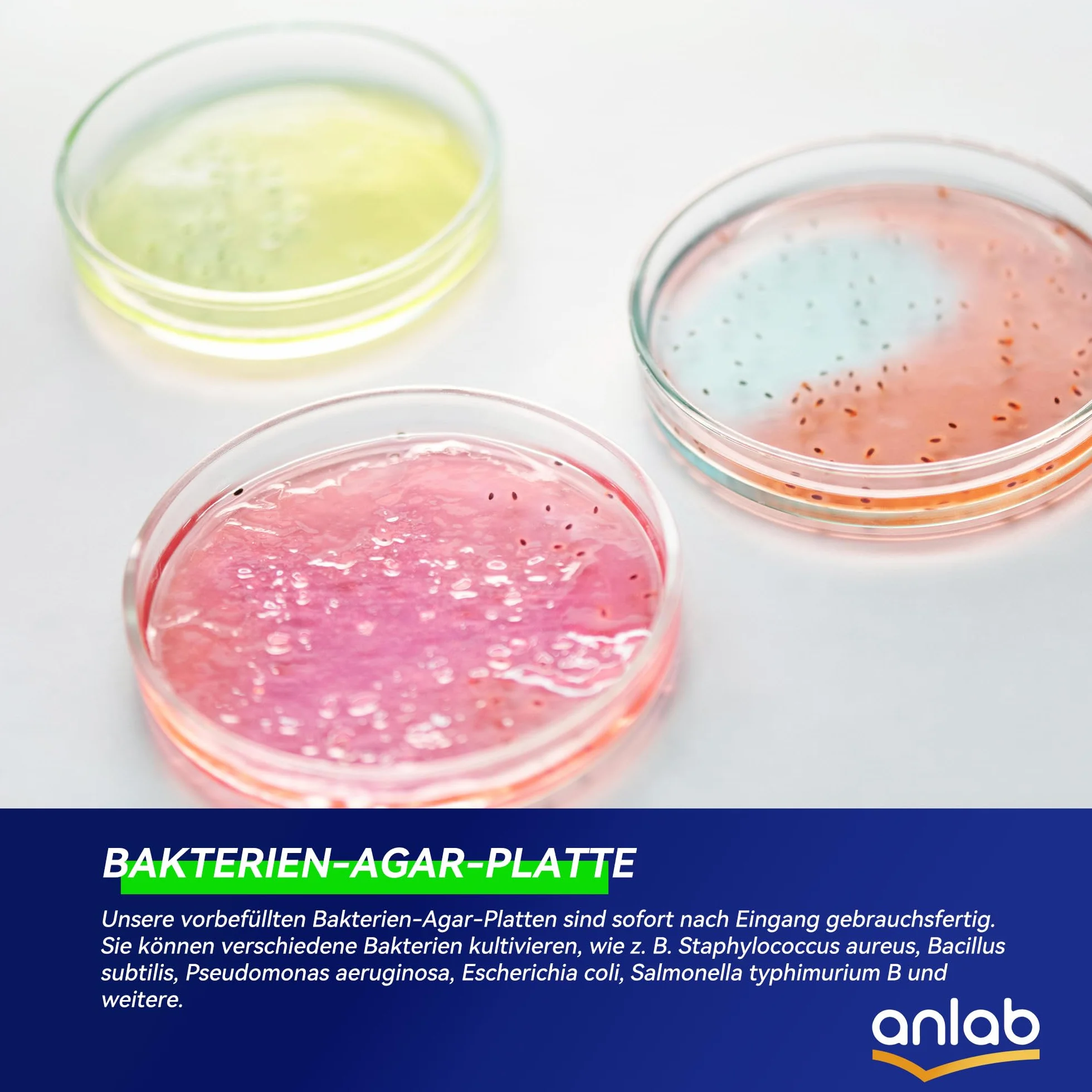 Nutrient Agar Petri Dishes Science Project Kit | Pre-Poured Agar Plates and Cotton Swabs for Science Experiments | Bacteria Science Kit - Sealed Separately (10)