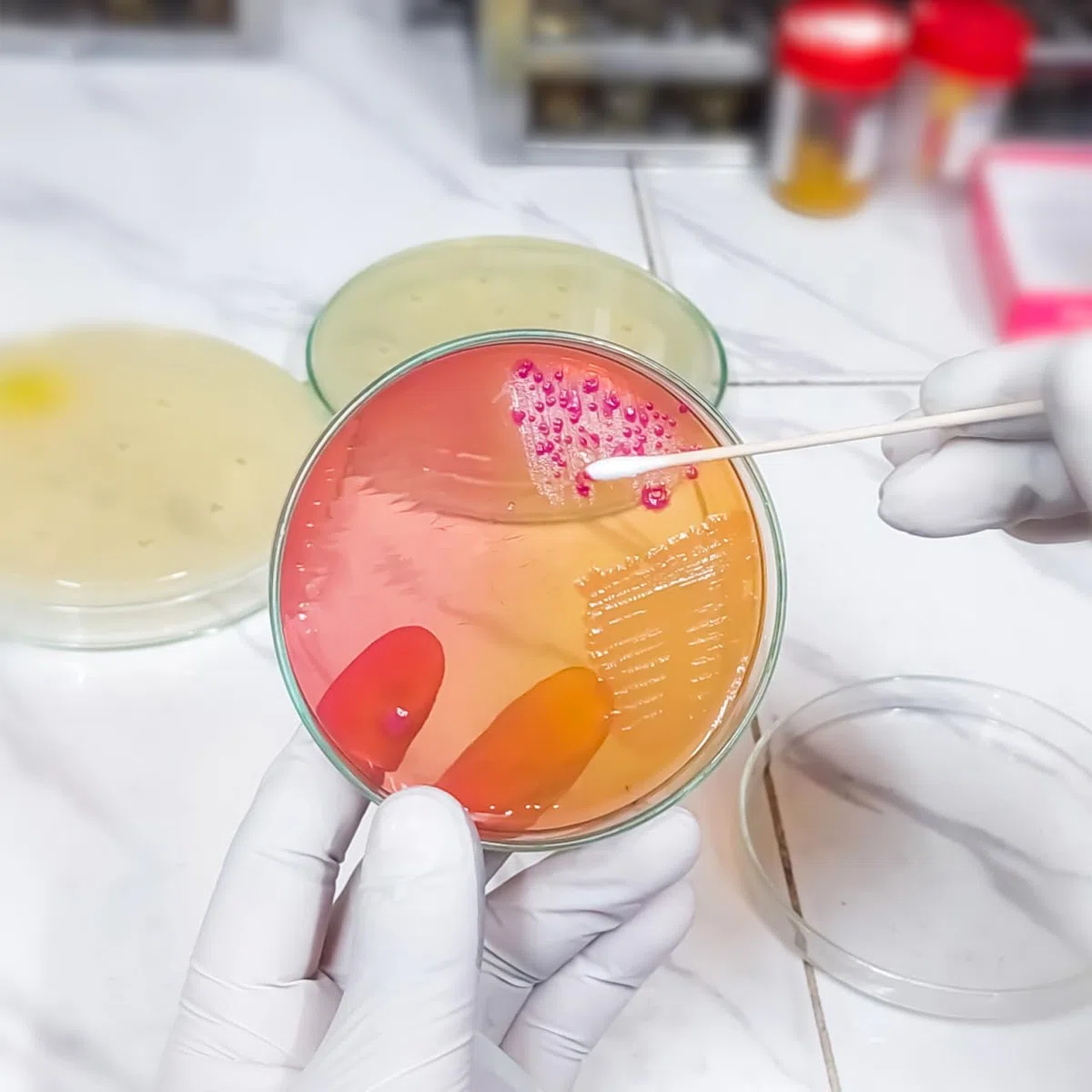 IMIKEYA 20 Stück Vorgegossene Agarplatten Agarplatten Für Wissenschaftliche Experimente Petrischalen Mit Nähragar Für Labor Schule Und Forschungsprojekte