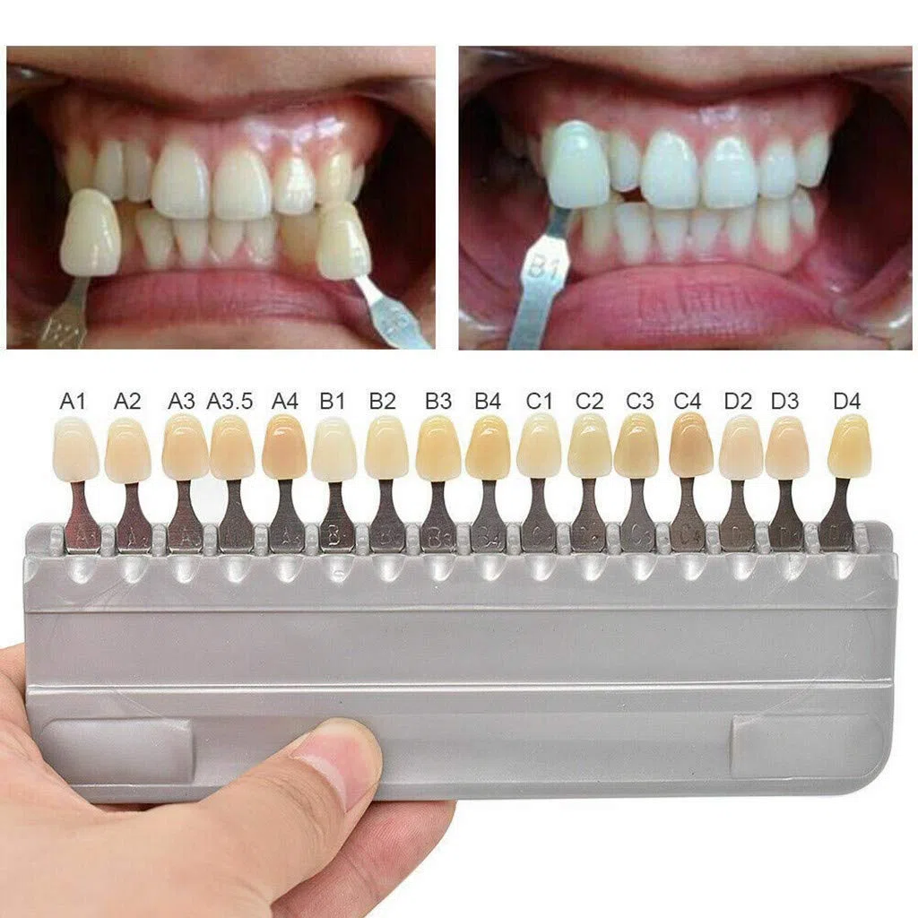 Dental 16 Farbdiagramm, digitaler Schattierungsführer, Zahnfarbvergleicher
