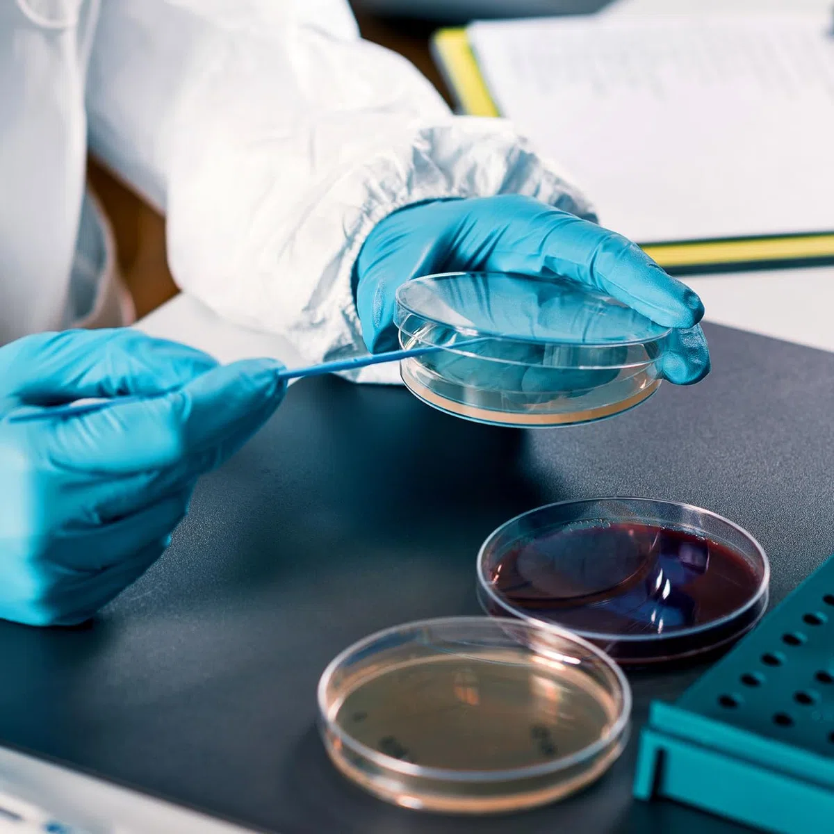 IMIKEYA 20 Stück Vorgegossene Agarplatten Agarplatten Für Wissenschaftliche Experimente Petrischalen Mit Nähragar Für Labor Schule Und Forschungsprojekte