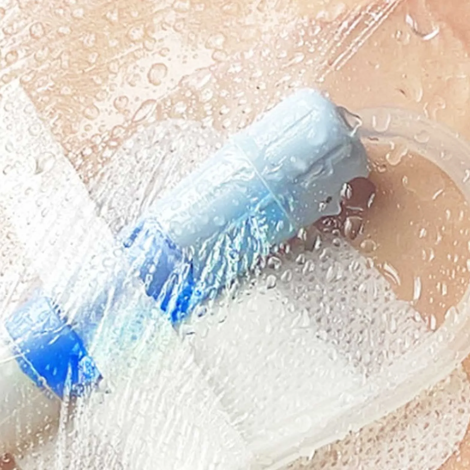 Wasserdichter Stretch-Klebeverband, Pd-Dialysekatheter-Duschabdeckung, Wundschutz For Peritonealdialyse-Anschlusszubehör Mit Antihaftbeschichtetem Mittelpolster(50pcs 20 x 20cm)